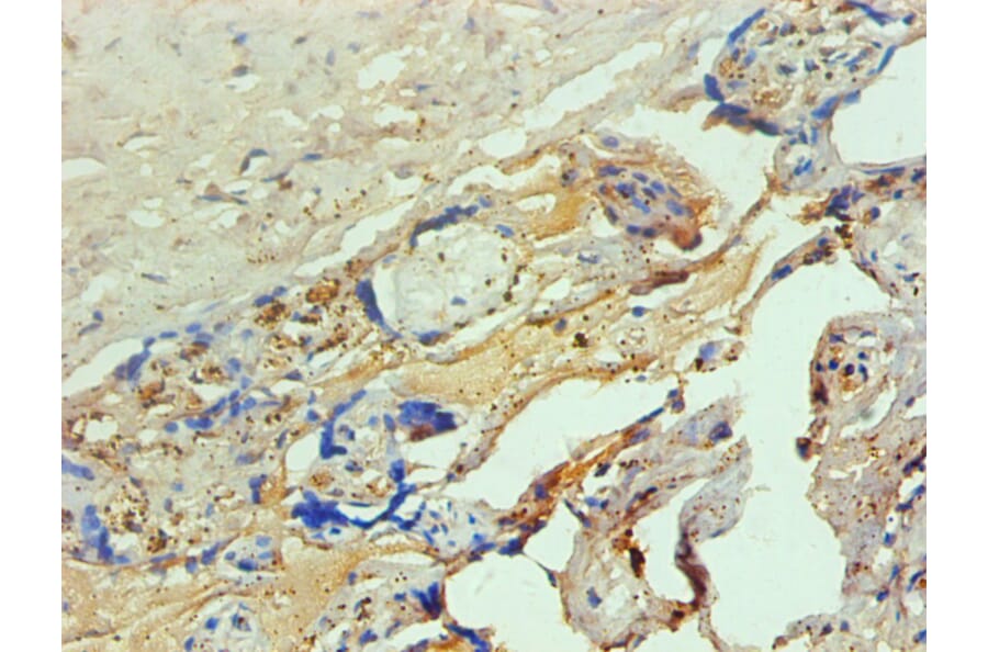 Immunohistochemistry - Hemoglobin Monoclonal Antibody from Signalway Antibody (42015) - Antibodies.com