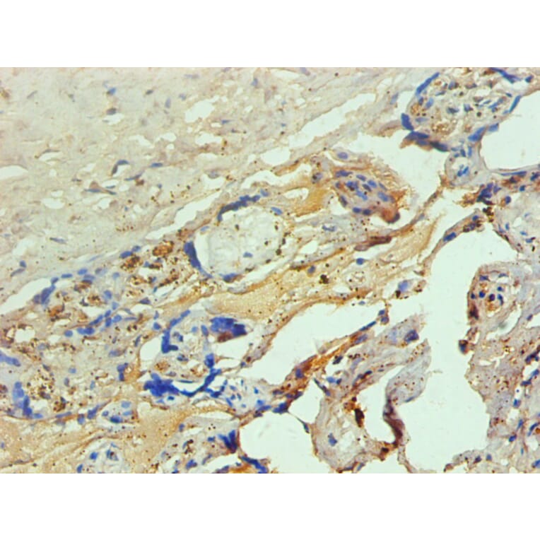 Immunohistochemistry - Hemoglobin Monoclonal Antibody from Signalway Antibody (42015) - Antibodies.com
