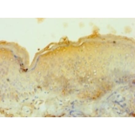 Immunohistochemistry - Tyrosinase Polyclonal Antibody from Signalway Antibody (42361) - Antibodies.com