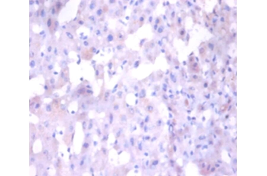 Immunohistochemistry - Angiogenin Polyclonal Antibody from Signalway Antibody (42438) - Antibodies.com
