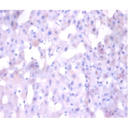 Immunohistochemistry - Angiogenin Polyclonal Antibody from Signalway Antibody (42438) - Antibodies.com
