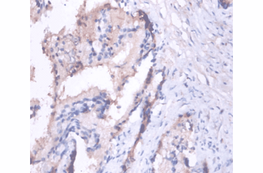 Immunohistochemistry - Matrilysin Polyclonal Antibody from Signalway Antibody (42487) - Antibodies.com