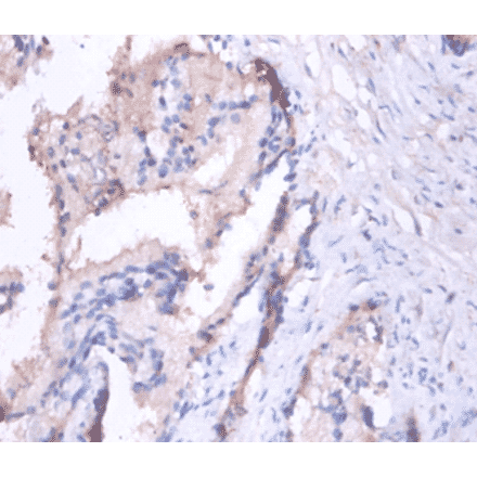 Immunohistochemistry - Matrilysin Polyclonal Antibody from Signalway Antibody (42487) - Antibodies.com