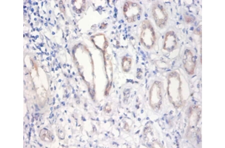 Immunohistochemistry - Nuclear pore membrane glycoprotein 210 Polyclonal Antibody from Signalway Antibody (42276)