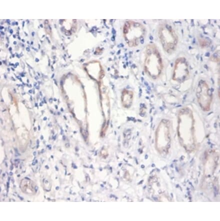 Immunohistochemistry - Nuclear pore membrane glycoprotein 210 Polyclonal Antibody from Signalway Antibody (42276)
