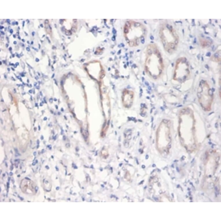 Immunohistochemistry - Nuclear pore membrane glycoprotein 210 Polyclonal Antibody from Signalway Antibody (42276)