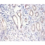Immunohistochemistry - Nuclear pore membrane glycoprotein 210 Polyclonal Antibody from Signalway Antibody (42276)