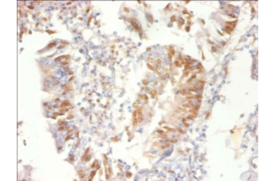 Immunohistochemistry - Proteasome activator complex subunit 3 Polyclonal Antibody from Signalway Antibody (42571)