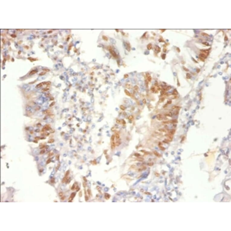 Immunohistochemistry - Proteasome activator complex subunit 3 Polyclonal Antibody from Signalway Antibody (42571)