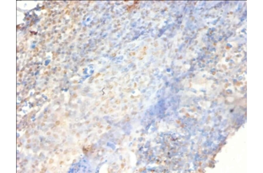 Immunohistochemistry - Proteasome activator complex subunit 3 Polyclonal Antibody from Signalway Antibody (42571)