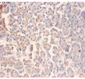 Immunohistochemistry - Glutamate receptor ionotropic, NMDA 2A Polyclonal Antibody from Signalway Antibody (42576)