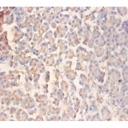 Immunohistochemistry - Glutamate receptor ionotropic, NMDA 2A Polyclonal Antibody from Signalway Antibody (42576)