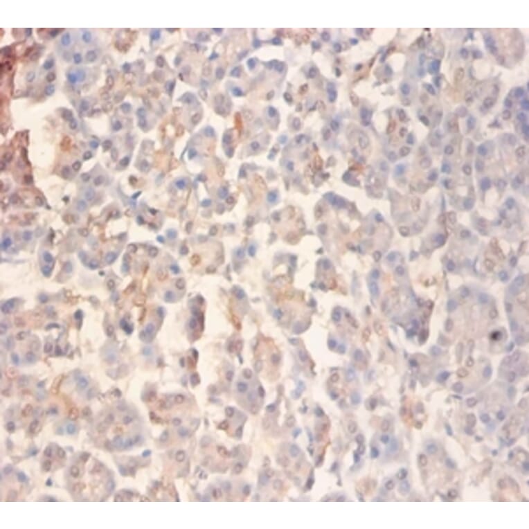 Immunohistochemistry - Glutamate receptor ionotropic, NMDA 2A Polyclonal Antibody from Signalway Antibody (42576)