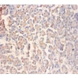Immunohistochemistry - Glutamate receptor ionotropic, NMDA 2A Polyclonal Antibody from Signalway Antibody (42576)