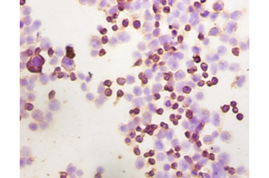 Immunohistochemistry - Integrin-linked protein kinase Polyclonal Antibody from Signalway Antibody (42192)