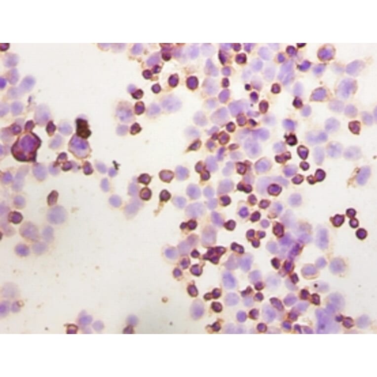 Immunohistochemistry - Integrin-linked protein kinase Polyclonal Antibody from Signalway Antibody (42192)