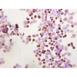 Immunohistochemistry - Integrin-linked protein kinase Polyclonal Antibody from Signalway Antibody (42192)