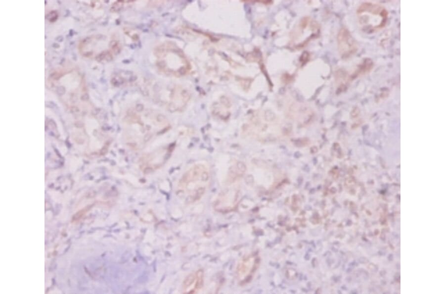 Immunohistochemistry - Integrin-linked protein kinase Polyclonal Antibody from Signalway Antibody (42192)