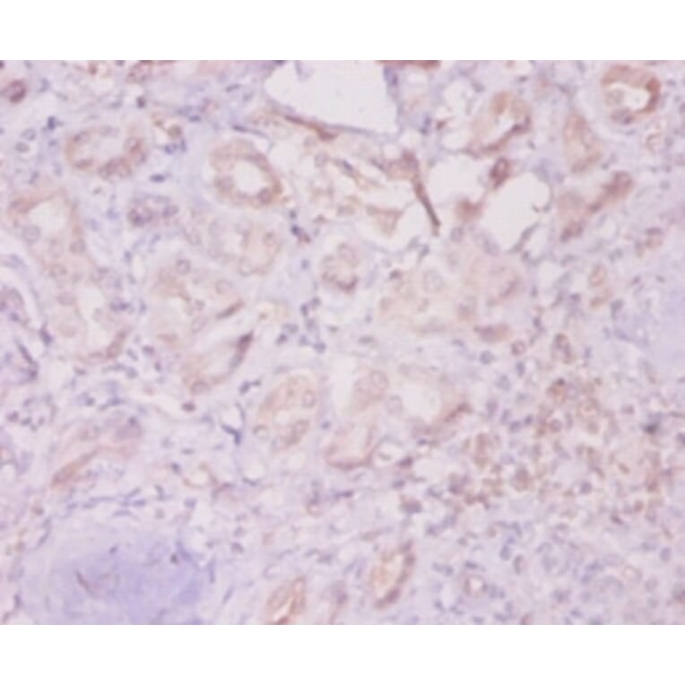 Immunohistochemistry - Integrin-linked protein kinase Polyclonal Antibody from Signalway Antibody (42192)
