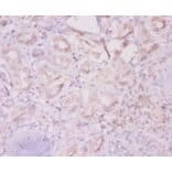 Immunohistochemistry - Integrin-linked protein kinase Polyclonal Antibody from Signalway Antibody (42192)