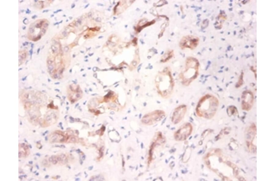 Immunohistochemistry - V-type proton ATPase subunit F Polyclonal Antibody from Signalway Antibody (42272)