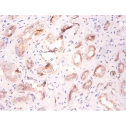 Immunohistochemistry - V-type proton ATPase subunit F Polyclonal Antibody from Signalway Antibody (42272)