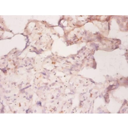Immunohistochemistry - Multidrug resistance protein 1 Polyclonal Antibody from Signalway Antibody (42547)