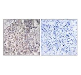 Immunohistochemistry - Cytochrome P450 4F2 Antibody from Signalway Antibody (34244) - Antibodies.com