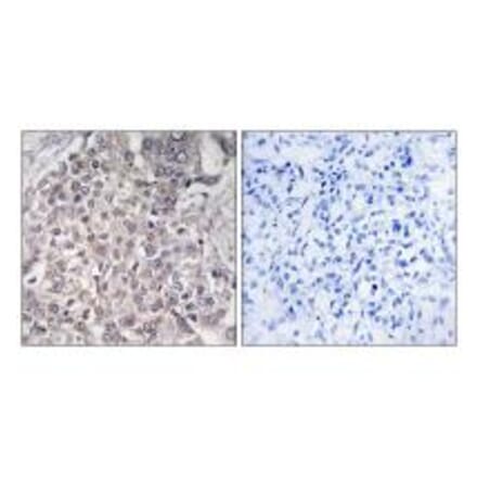 Immunohistochemistry - Cytochrome P450 4F2 Antibody from Signalway Antibody (34244) - Antibodies.com