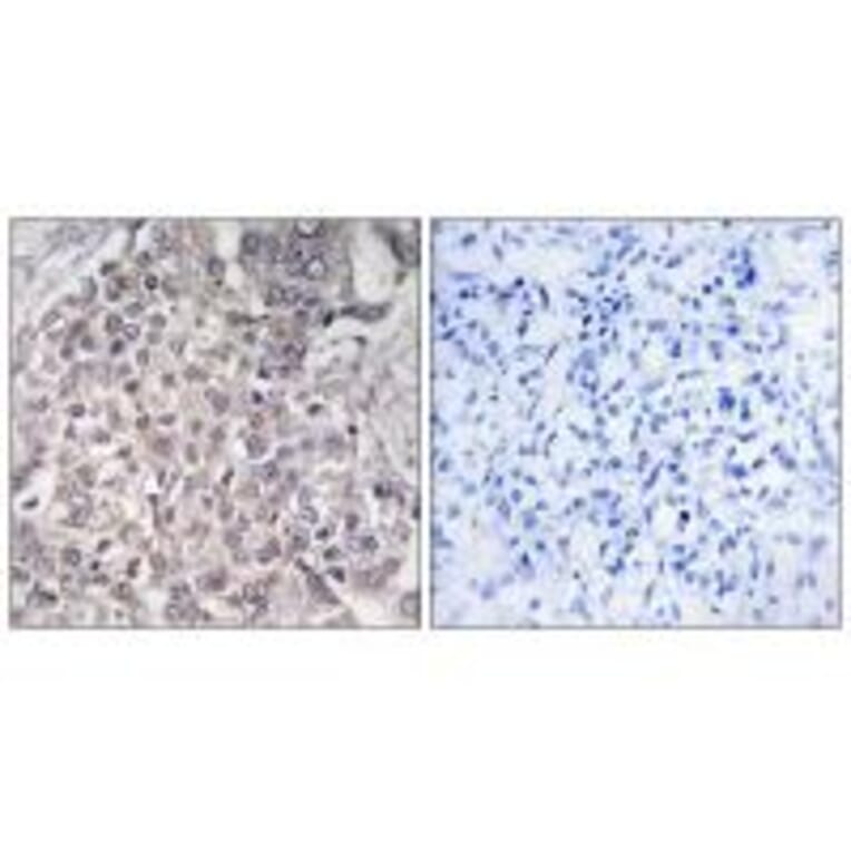 Immunohistochemistry - Cytochrome P450 4F2 Antibody from Signalway Antibody (34244) - Antibodies.com