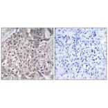 Immunohistochemistry - Cytochrome P450 4F2 Antibody from Signalway Antibody (34244) - Antibodies.com