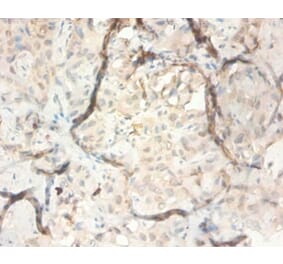 Immunohistochemistry - Serpin B3 Polyclonal Antibody from Signalway Antibody (42534) - Antibodies.com