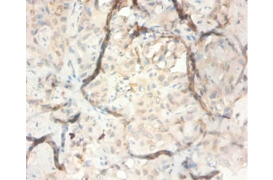 Immunohistochemistry - Serpin B3 Polyclonal Antibody from Signalway Antibody (42534) - Antibodies.com