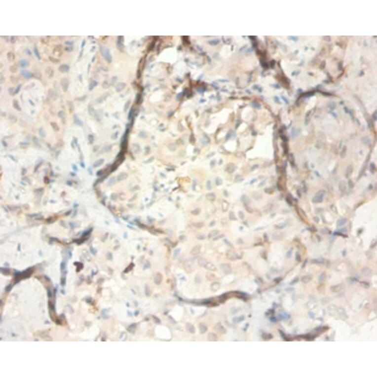 Immunohistochemistry - Serpin B3 Polyclonal Antibody from Signalway Antibody (42534) - Antibodies.com