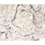 Immunohistochemistry - Serpin B3 Polyclonal Antibody from Signalway Antibody (42534) - Antibodies.com