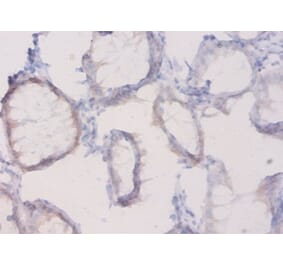 Immunohistochemistry - Plexin-A1 Polyclonal Antibody from Signalway Antibody (42579) - Antibodies.com