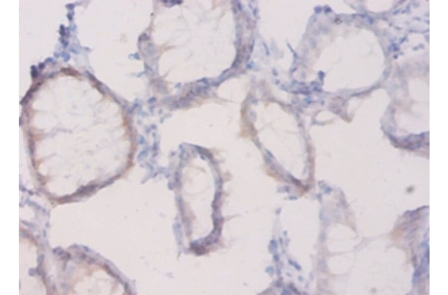 Immunohistochemistry - Plexin-A1 Polyclonal Antibody from Signalway Antibody (42579) - Antibodies.com