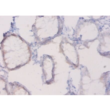 Immunohistochemistry - Plexin-A1 Polyclonal Antibody from Signalway Antibody (42579) - Antibodies.com