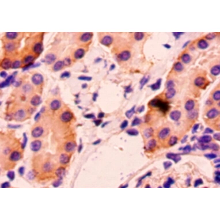 Immunohistochemistry - Hepatitis A virus cellular receptor 2 Polyclonal Antibody from Signalway Antibody (42200)