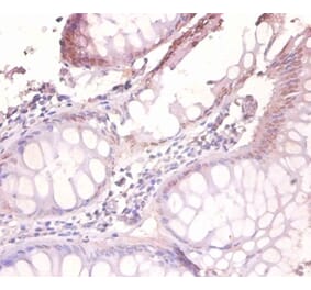 Immunohistochemistry - Vesicle-associated membrane protein 7 Polyclonal Antibody from Signalway Antibody (42365)