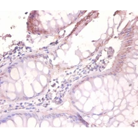 Immunohistochemistry - Vesicle-associated membrane protein 7 Polyclonal Antibody from Signalway Antibody (42365)