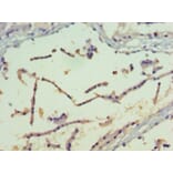 Immunohistochemistry - Serine/threonine-protein kinase PAK 4 Polyclonal Antibody from Signalway Antibody (42433)