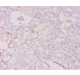 Immunohistochemistry - Granulocyte colony-stimulating factor Polyclonal Antibody from Signalway Antibody (42459)