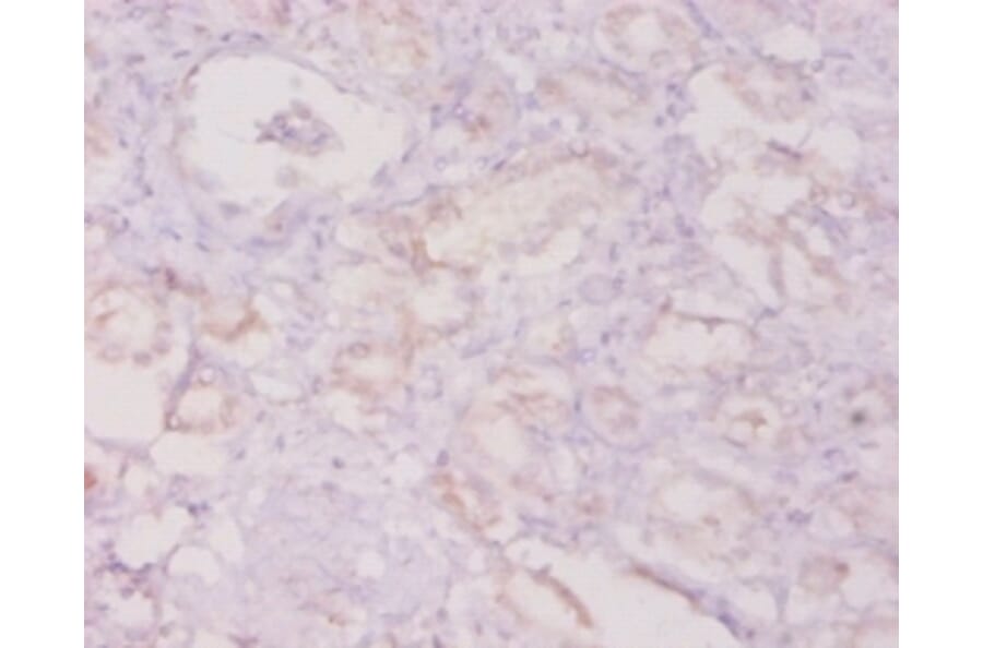 Immunohistochemistry - Granulocyte colony-stimulating factor Polyclonal Antibody from Signalway Antibody (42459)