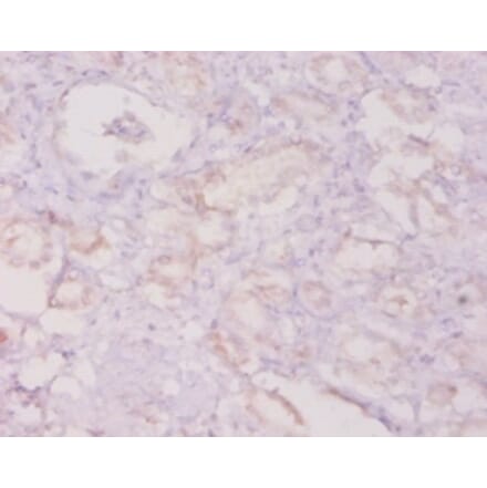 Immunohistochemistry - Granulocyte colony-stimulating factor Polyclonal Antibody from Signalway Antibody (42459)