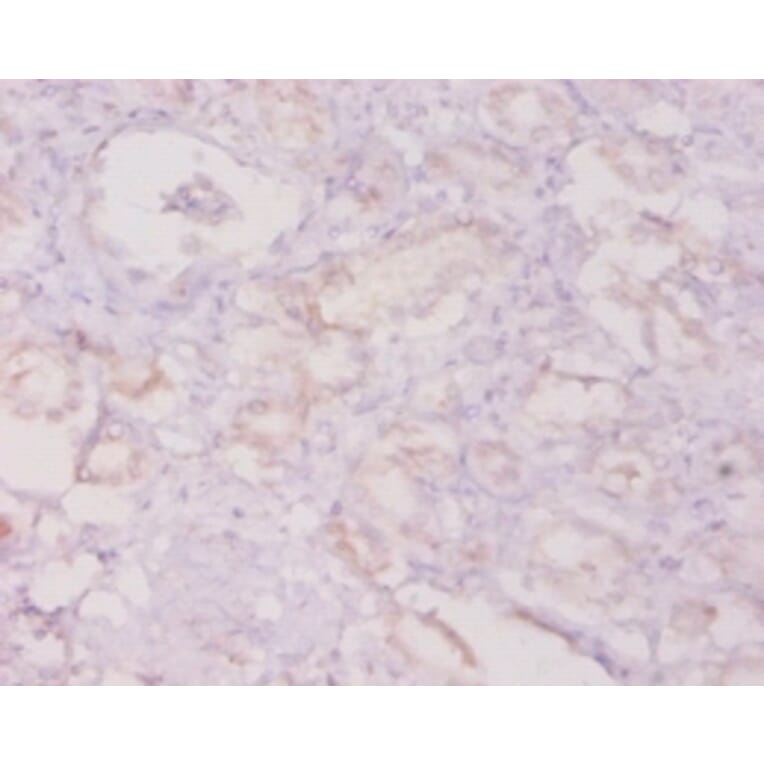 Immunohistochemistry - Granulocyte colony-stimulating factor Polyclonal Antibody from Signalway Antibody (42459)