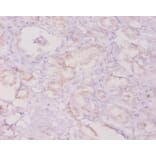 Immunohistochemistry - Granulocyte colony-stimulating factor Polyclonal Antibody from Signalway Antibody (42459)