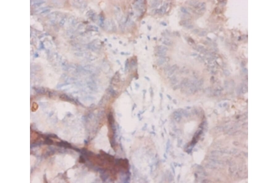 Immunohistochemistry - Granulocyte colony-stimulating factor Polyclonal Antibody from Signalway Antibody (42459)