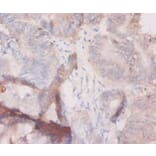 Immunohistochemistry - Granulocyte colony-stimulating factor Polyclonal Antibody from Signalway Antibody (42459)