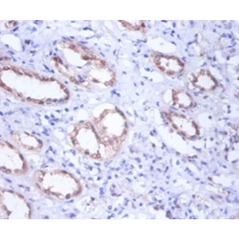 Immunohistochemistry - Glucose-6-phosphate isomerase Polyclonal Antibody from Signalway Antibody - Antibodies.com